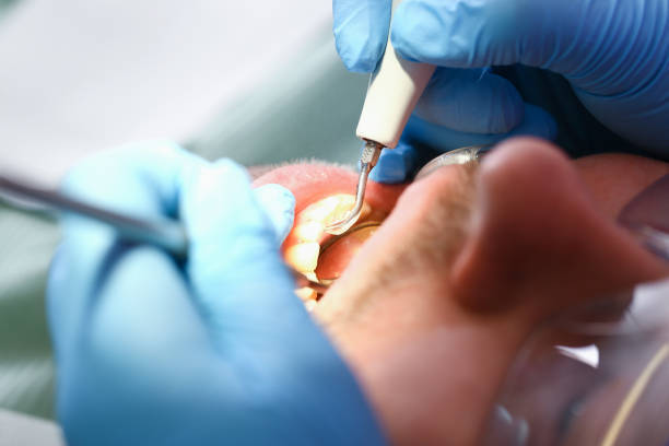 Best Emergency Treatment for Oral Infections in Rollingwood, TX