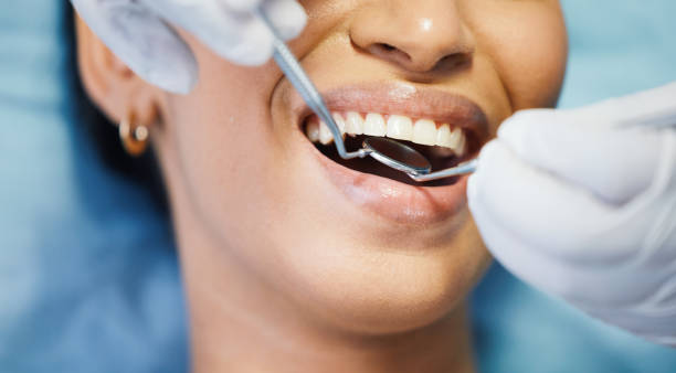 Best Broken or Chipped Tooth Repair in Rollingwood, TX